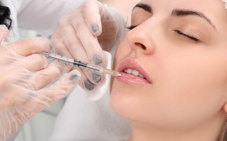 Phẫu thuật làm đầy và làm mỏng môi