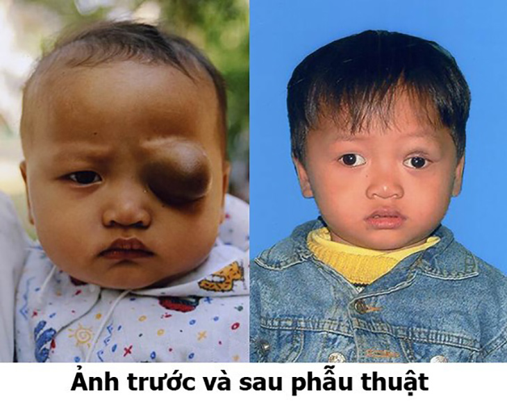 U Mau 1