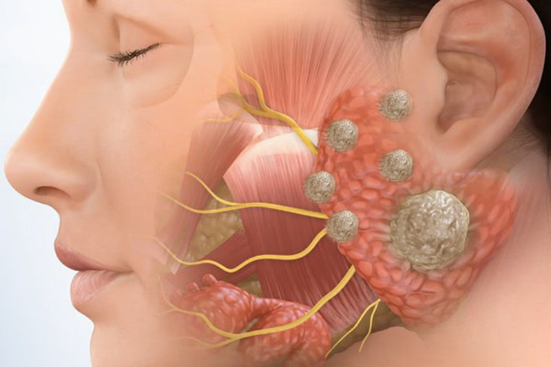 u tuyến nước bọt