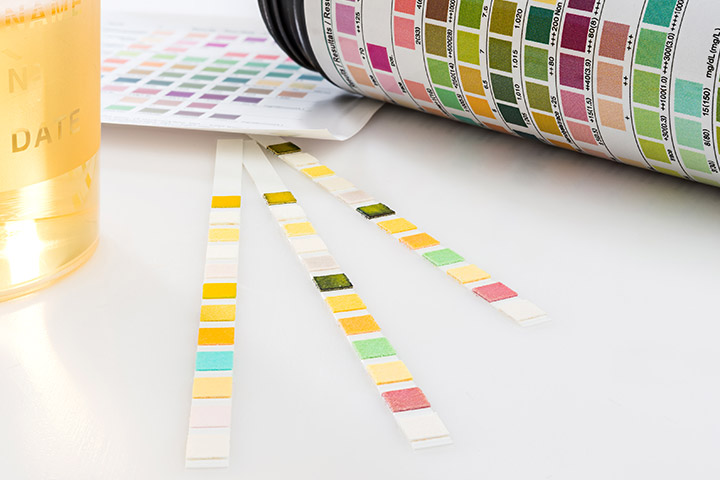 Xét nghiệm máu và nước tiểu khi mang thai