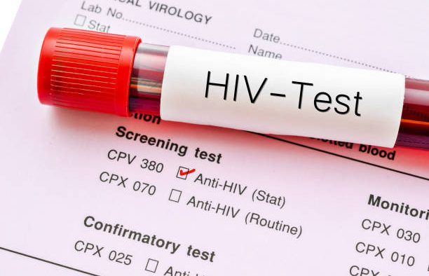 xét nghiệm HIV