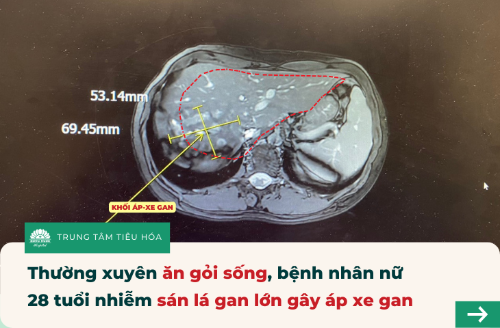 bien-chung-cua-san-la-gan-2