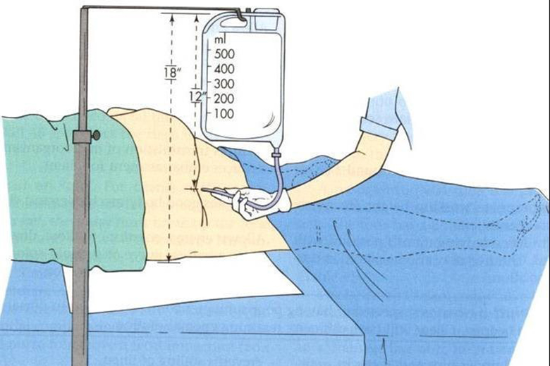 Bao Lau Nen Noi Soi Dai Trang 2