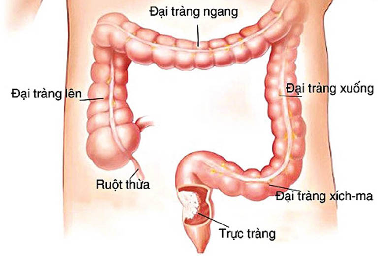trực tràng