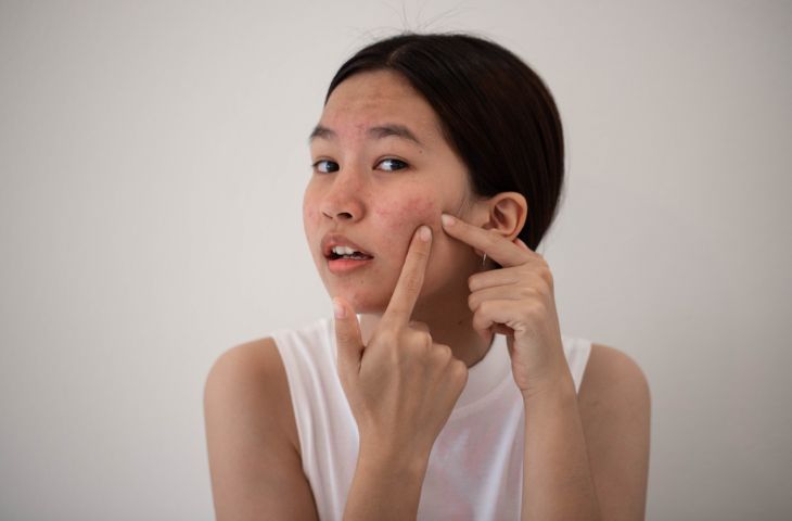 Bệnh ngoài da ở mẹ bầu