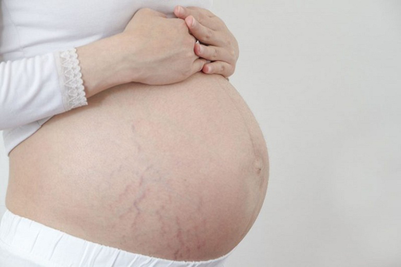 Bệnh ngoài da ở mẹ bầu