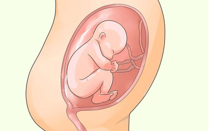 Đa ối có khả năng phải đình trì thai sớm nếu có những triệu chứng trầm trọng