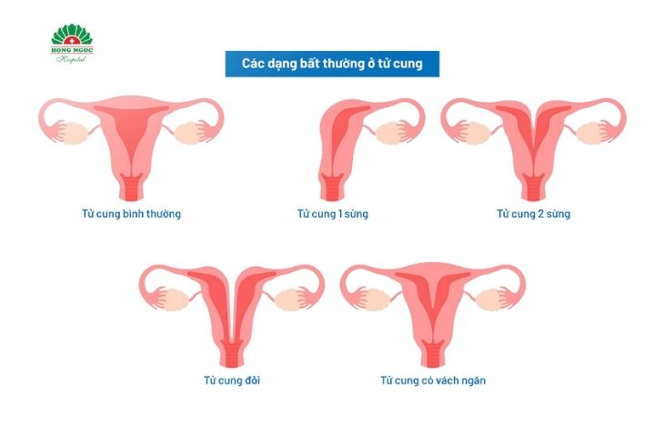 Bất thường ở tử cung