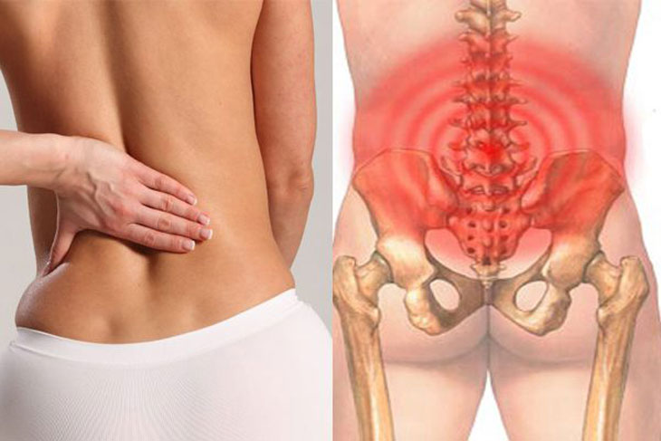 Đau xương cụt sau sinh
