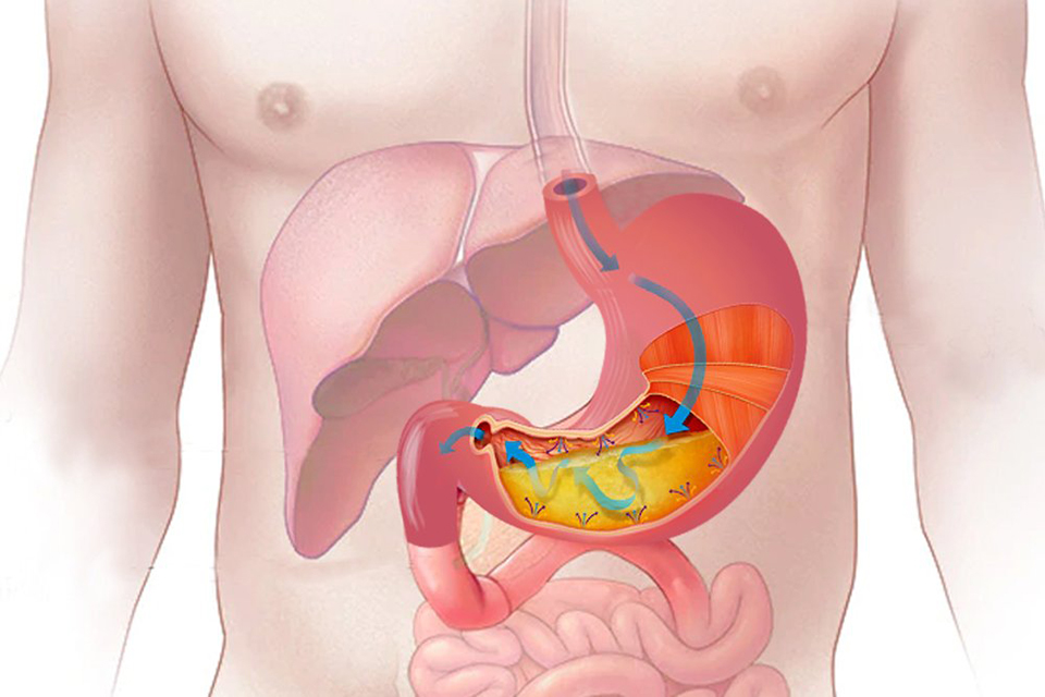 Ợ hơi đau thượng vị