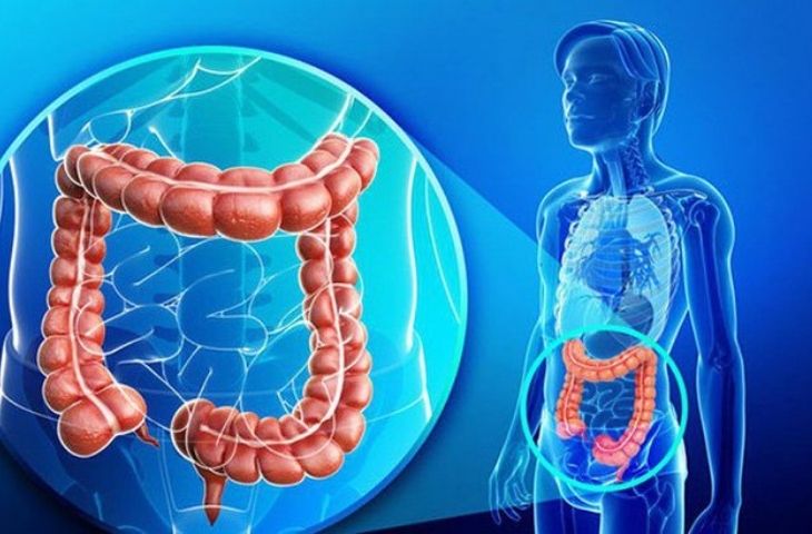 Hội chứng ruột kích thích có chữa khỏi được không?