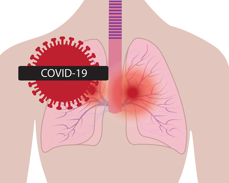 Hầu hết các bệnh nhân COVID - 19 đều có nguy cơ cao mắc di chứng hậu COVID phổi yếu