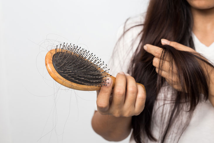 Hậu COVID bị rụng tóc xảy ra phổ biến đối với những bệnh nhân sau điều trị
