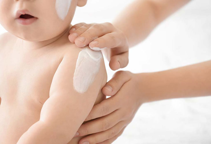 cách trị mề đay tại nhà cho trẻ