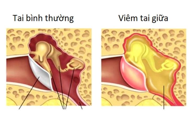  width=