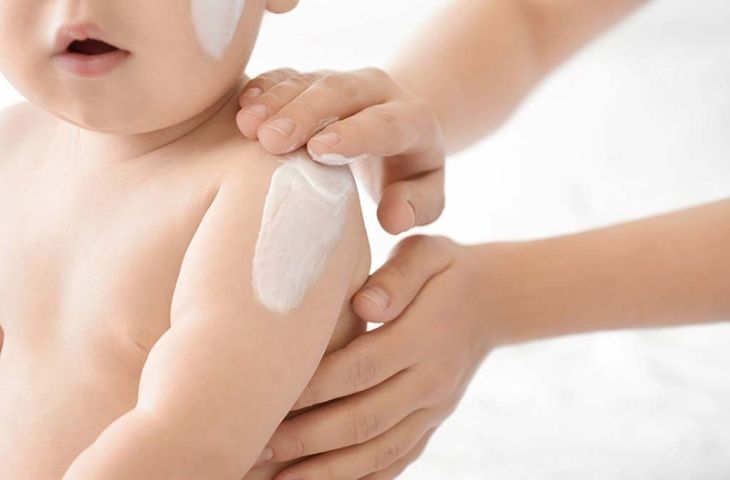 trị nổi mề đay
