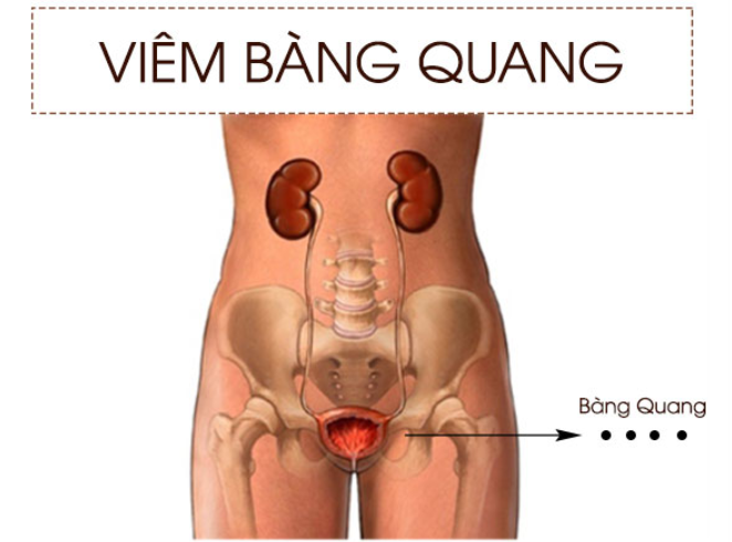bien-chung-soi-bang-quang
