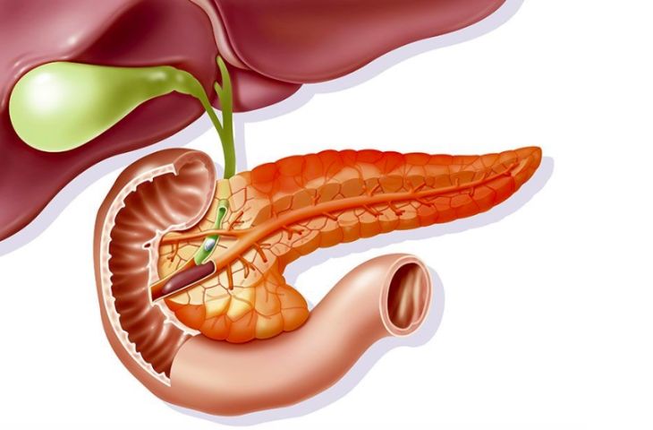 sỏi tụy có nguy hiểm không