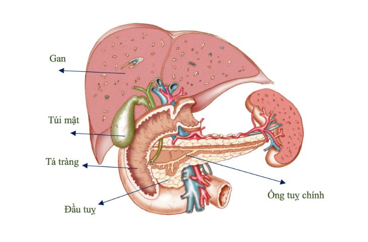 sỏi tụy