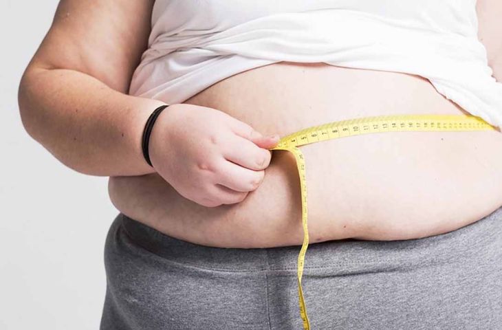 Người bị thừa cân, béo phì là đối tượng dễ mắc bệnh gút