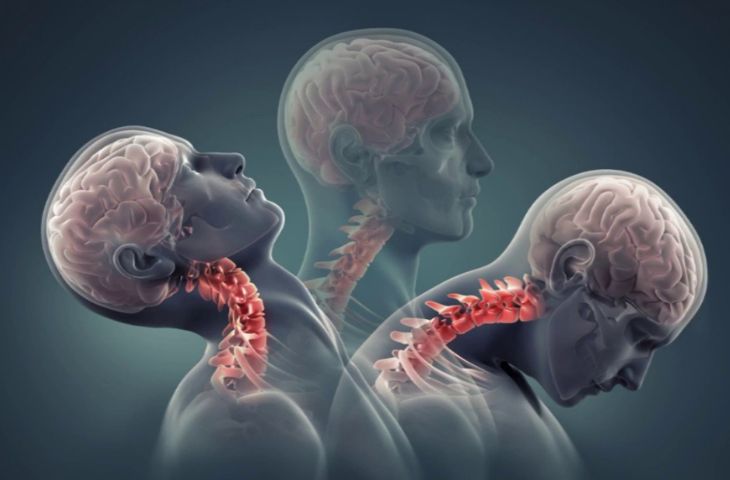 đau cổ vai gáy có nguy hiểm không