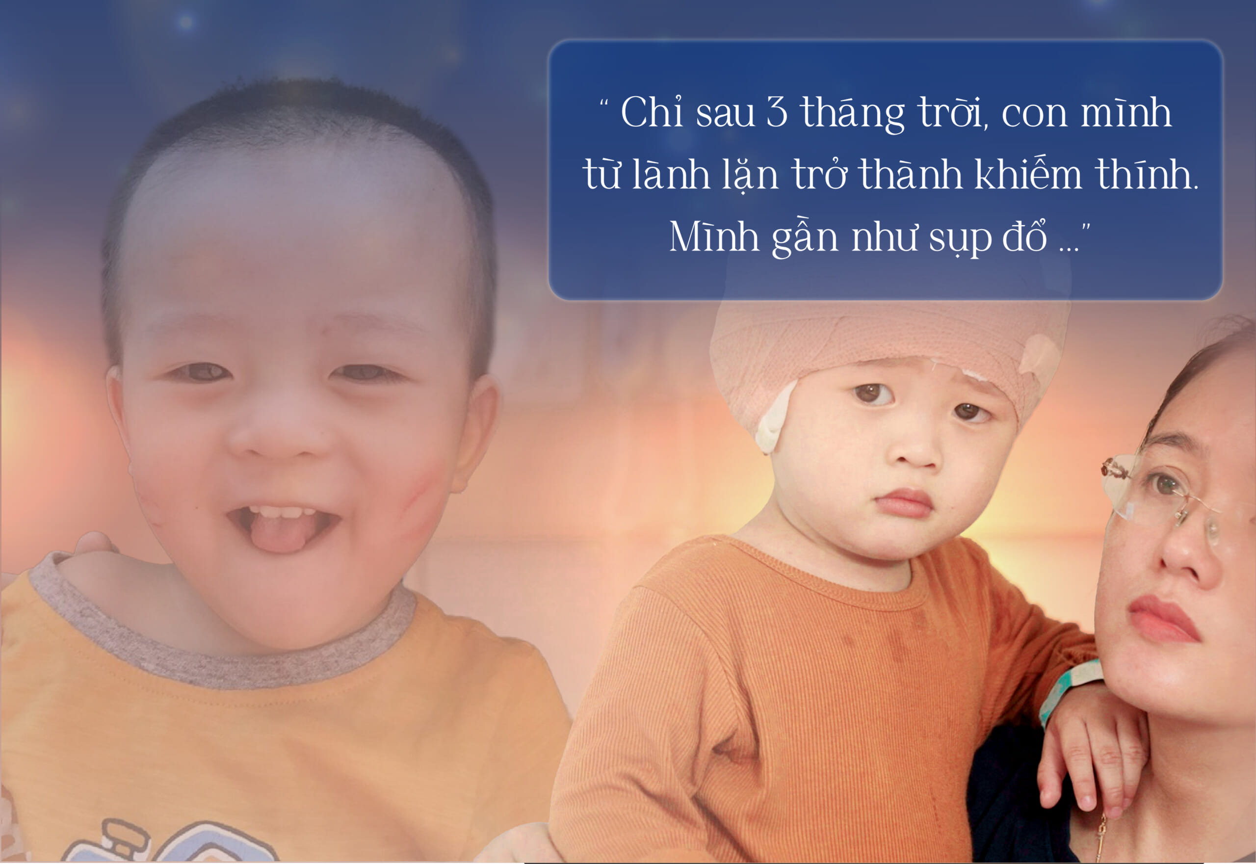 Bé trai bị viêm màng não sau một trận ốm