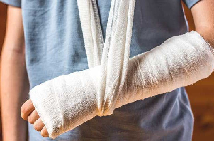 Nguyên nhân gây loãng xương