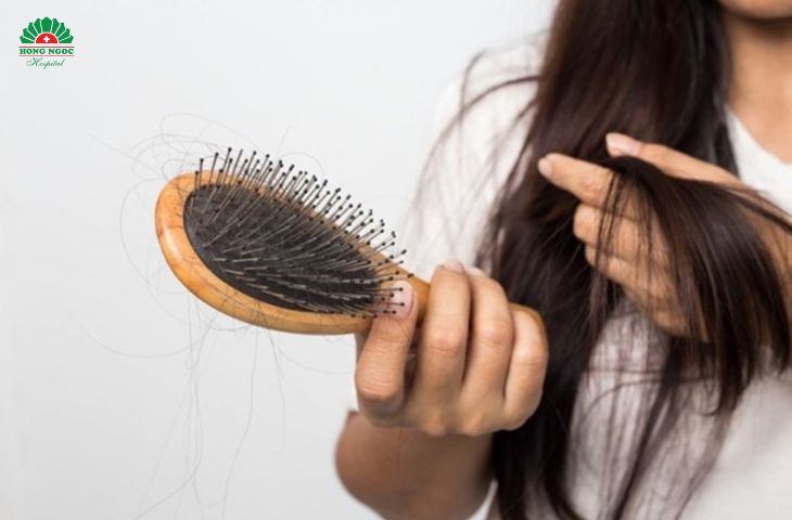 Rụng tóc là một triệu chứng suy giáp