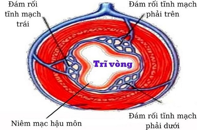 When mixed hemorrhoidal cushions enlarge and merge to occupy almost the entire circumference of the anal canal, the condition is referred to as circumferential hemorrhoids.