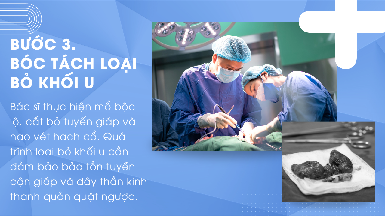 Phẫu thuật ung thư tuyến giáp