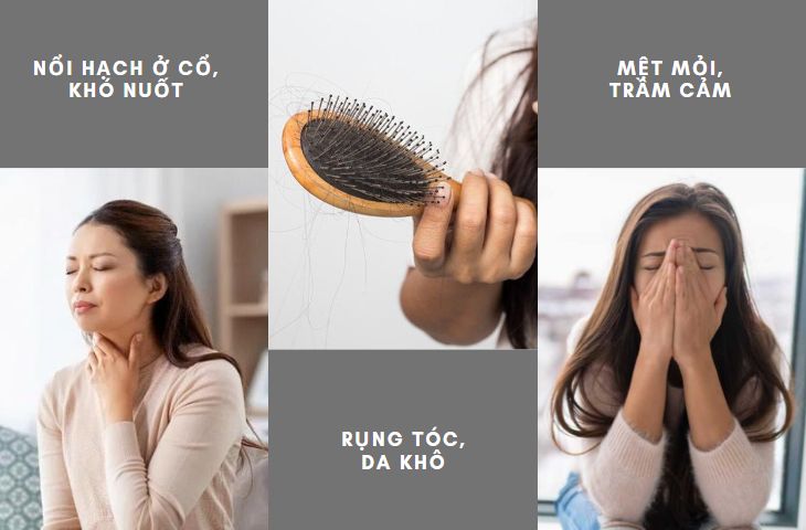 Bệnh nhân cần siêu âm tuyến giáp khi có các triệu chứng bệnh tuyến giáp