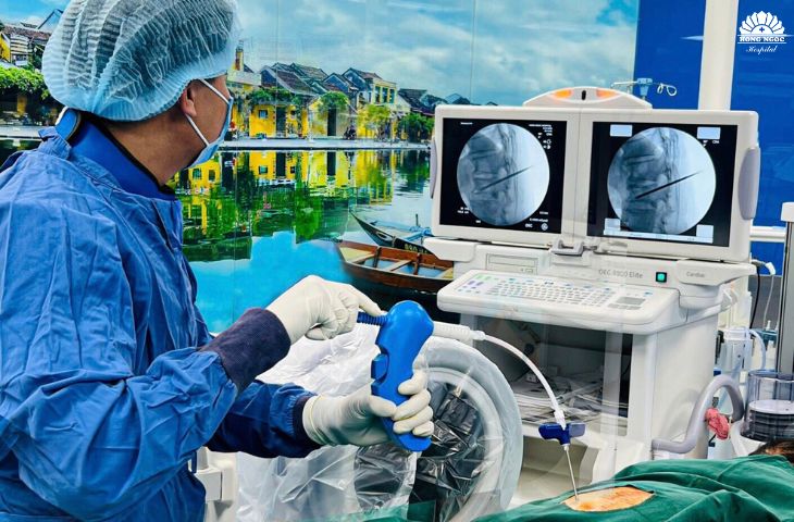 bơm xi măng cột sống 