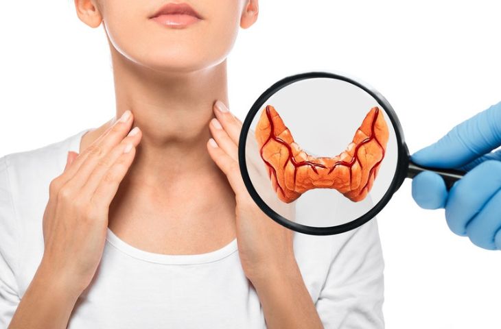 Điều trị cường giáp cần nhận biết chính xác biểu hiện của bệnh
