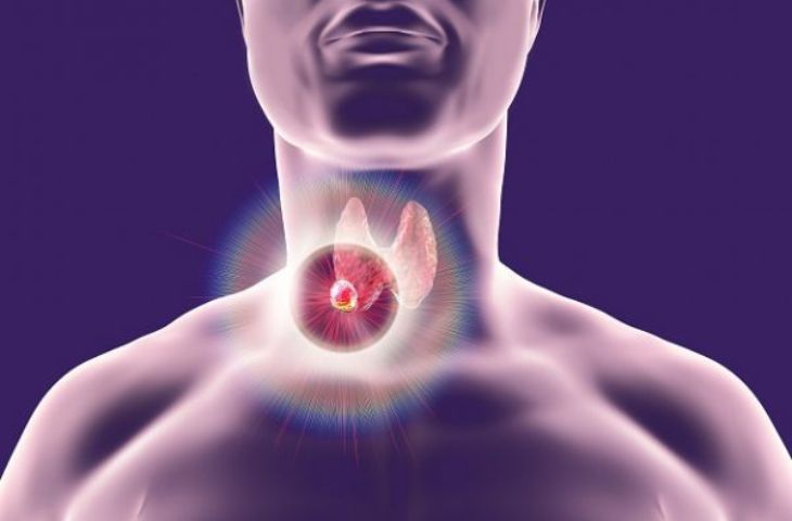 Siêu âm tuyến giáp phát hiện ra khối u bất thường ở cổ