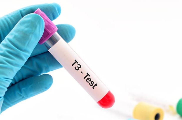 Xét nghiệm tuyến giáp với hormone T3