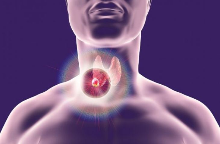 Biến chứng của bệnh tuyến giáp nguy hiểm như thế nào?