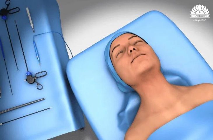 Bước 1 mổ nội soi tuyến giáp qia đường tiền đình miệng