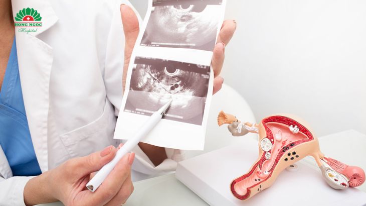 Đau bụng kinh dữ dội