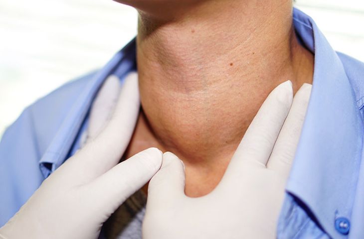 Điều trị bệnh tuyến giáp như thế nào?