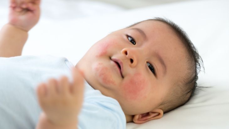 Tiêm phòng cho trẻ từ 1 đến 5 tuổi
