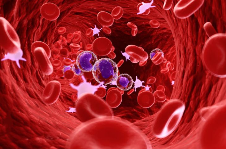 Biến chứng viêm xoang đến mạch máu