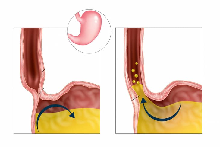 trao-nguoc-thuc-quan-do-a