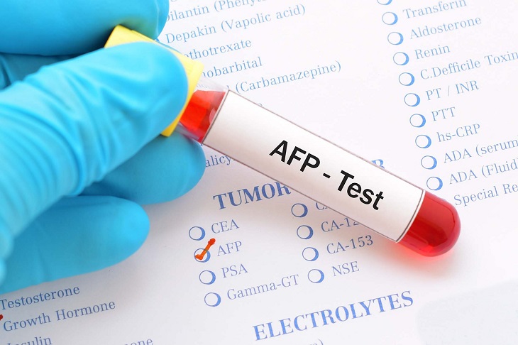 Xét nghiệm AFP xác định chỉ số ung thư gan&nbsp;