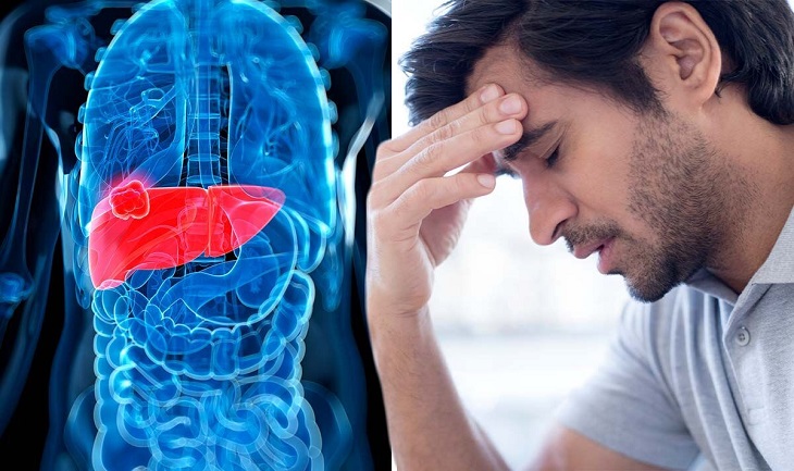 Tiên lượng sống của người bị ung thư gan phụ thuộc vào nhiều yếu tố khác nhau