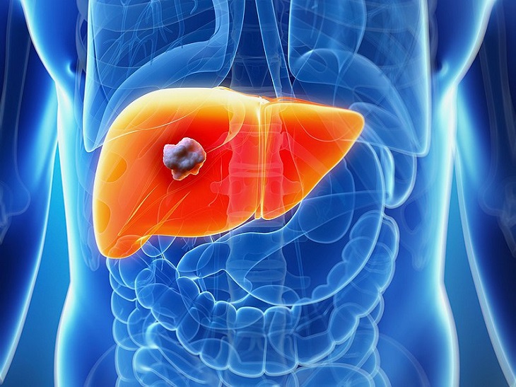 The smaller the tumor size, the higher the patient’s survival rate.