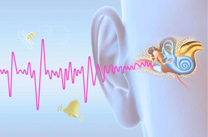 Triệu chứng rối loạn thính lực