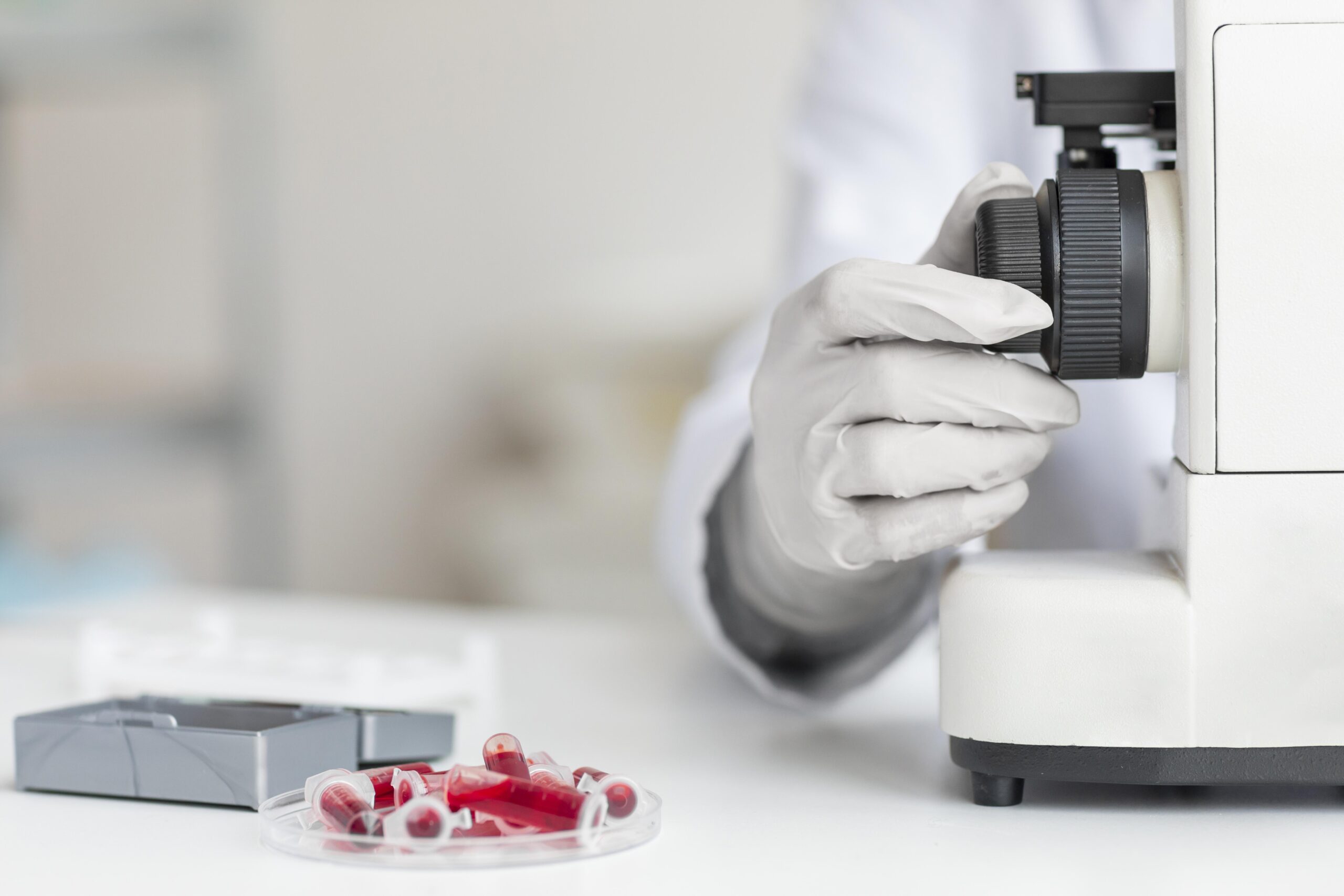 tầm soát ung thư phổi ở đâu