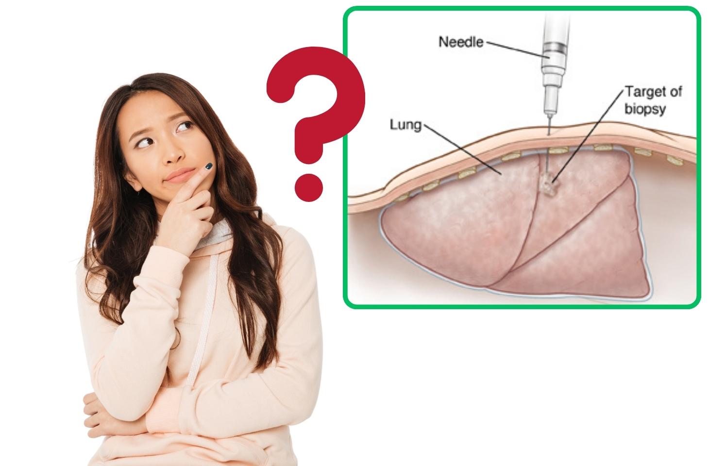 lấy sinh thiết phổi có nguy hiểm không