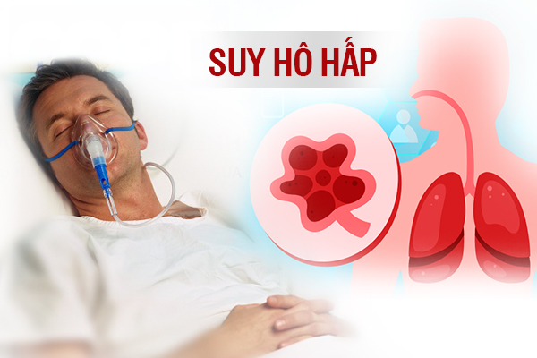 suy hô hấp