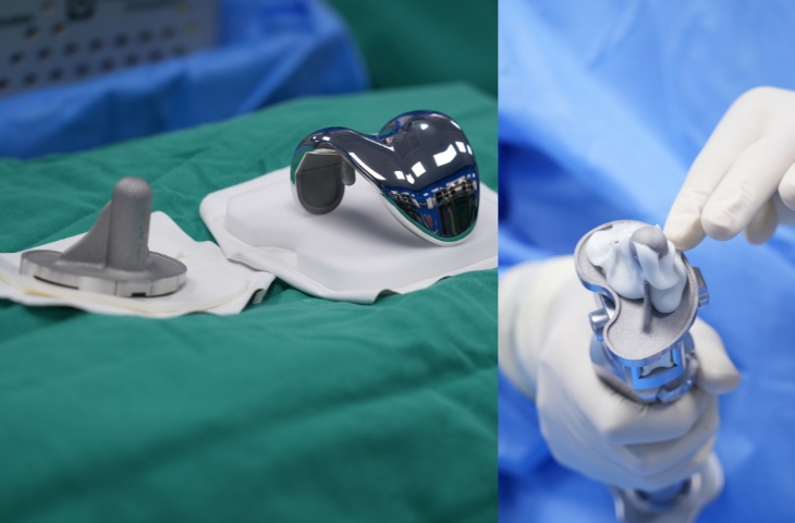 các loại khớp gối nhân tạo